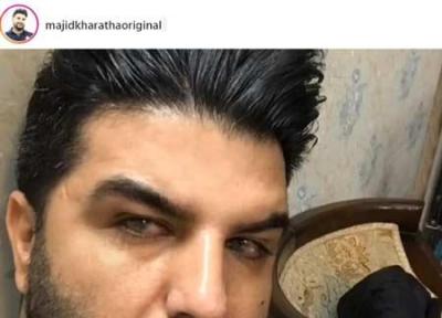 چشمان مجید خراطها؛ قربانی خطای پزشکی